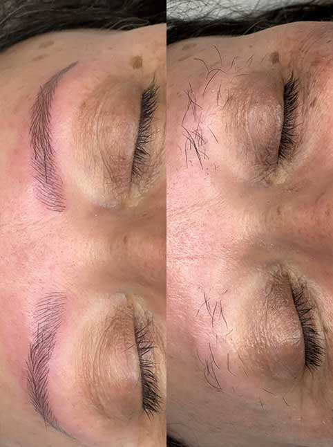 microblanding-abba-beauty